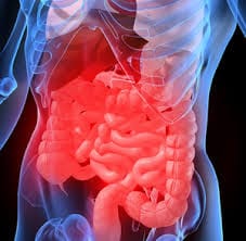 Gut inflammation